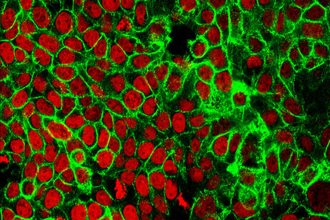 Cellule del tumore del colon-retto (fonte: NCI Center for Cancer Research)