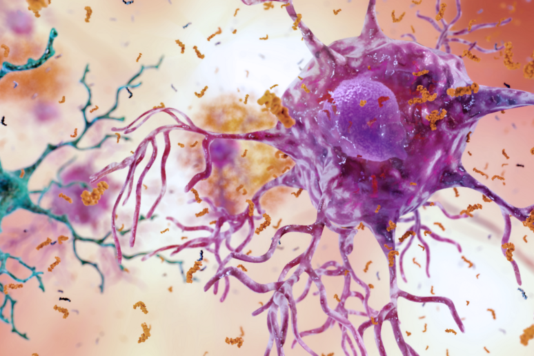Le cellule nervose colpite dall 'infiammazione nella malattia di Alzheimer (fonte: National Institute on Aging, NIH CC BY-NC 2.0) - RIPRODUZIONE RISERVATA