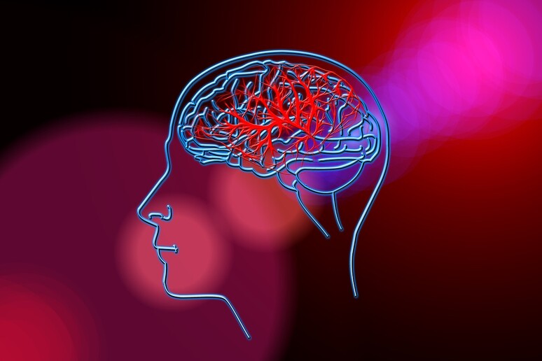 L ' emorragia cerebrale terzo killer dopo infarto e tumori (fonte: Needpix) - RIPRODUZIONE RISERVATA