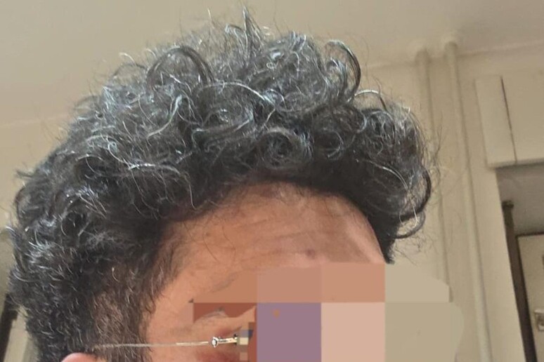 - RIPRODUZIONE RISERVATA
