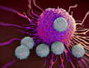 Leucemia mieloide acuta, con nuova cura balzo sopravvivenza (ANSA)