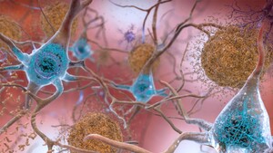 In azzurro la proteina tau che nella malattia di Alzheimer si accumula nel cervello (fonte: National Institute on Aging) (ANSA)