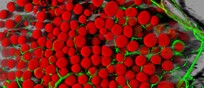 Cellule adipose (in rosso) e vasi sanguigni (in verde) (fonte: Daniela Malide, National Heart, Lung, and Blood Institute/NIH da Flickr PDM 1.0)