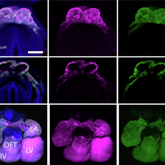 I ricercatori hanno utilizzato una tecnica chiamata ‘microscopia a foglio di luce’ (fonte: Abukar et al, The Embo Journal, 2025)