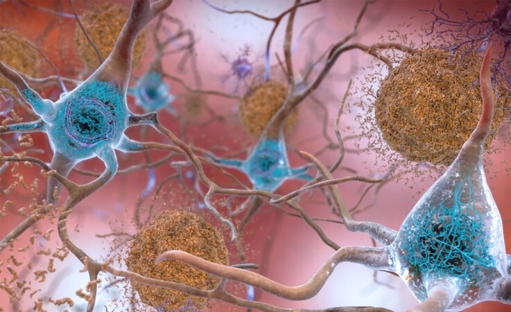 In azzurro la proteina tau che nella malattia di Alzheimer si accumula nel cervello (fonte: National Institute on Aging) © Ansa