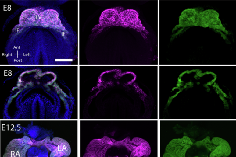 I ricercatori hanno utilizzato una tecnica chiamata ‘microscopia a foglio di luce’ (fonte: Abukar et al, The Embo Journal, 2025) - RIPRODUZIONE RISERVATA